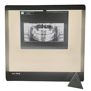 نگاتسکوپ عاج طب مدل CTX-PG